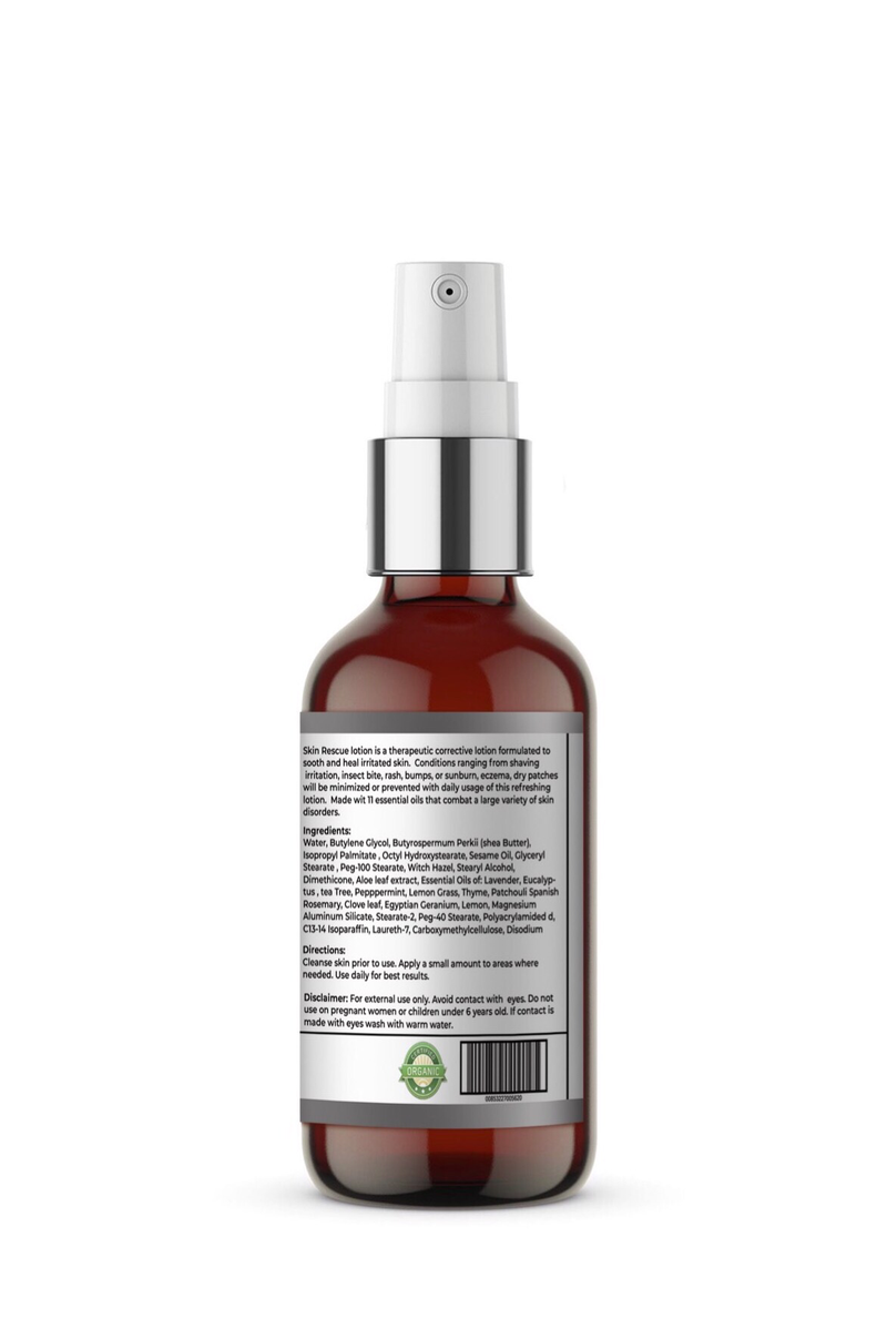 Xotics Skin Rescue Lotion 4oz
